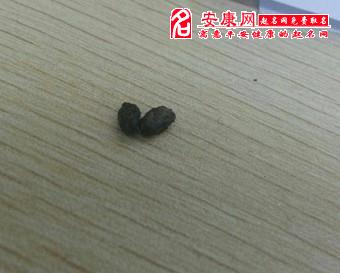 梦见有人舔屎