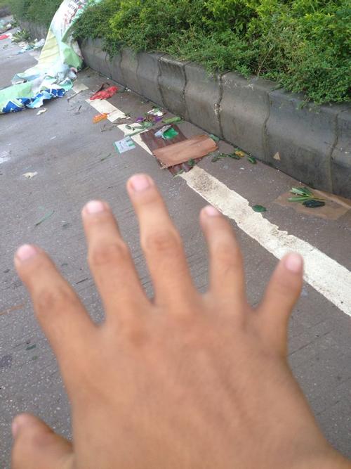 梦见有人治脚